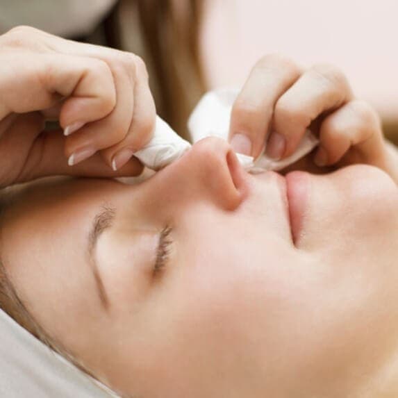 Acne Correction